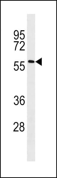 ACSF2 Antibody (aa587-615)