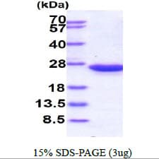 Human RAC2 Protein (Recombinant His)