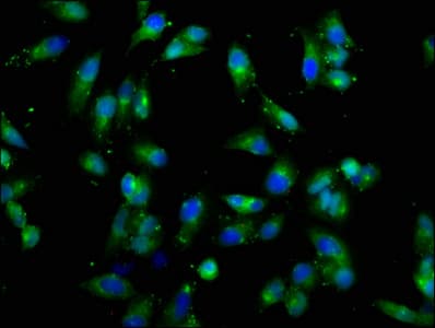 CSF2RB / CD131 Antibody