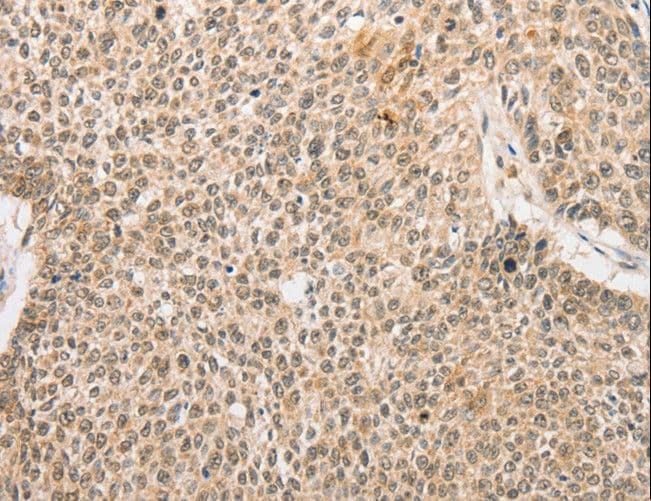 Polyclonal Rabbit anti-Human RPL26L1 Antibody (IHC)