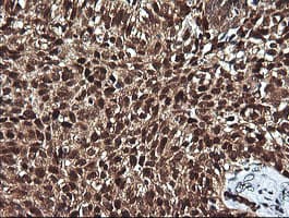 FAK / Focal Adhesion Kinase Antibody (clone OTI4A8)
