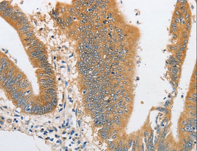 ARHGAP5 / RhoGAP5 Antibody