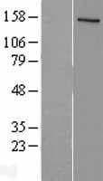 NCOA1 / SRC-1 Protein (Over-Expression Lysate Myc-DDK (Flag))