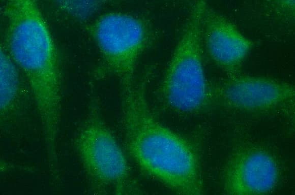SCARB1 / SR-BI Antibody (clone OTI1G4)