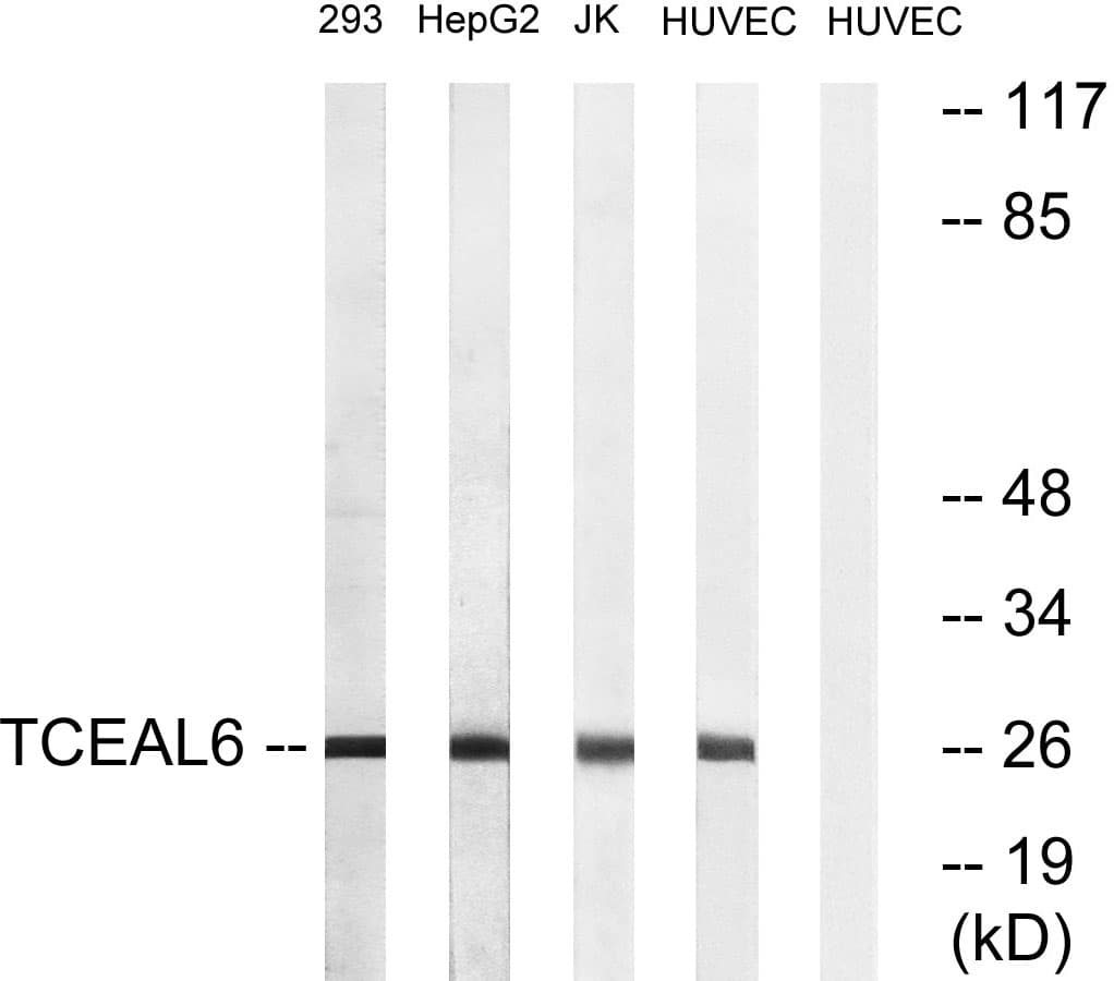 Polyclonal Rabbit anti-Human TCEAL6 Antibody (aa61-110, WB)