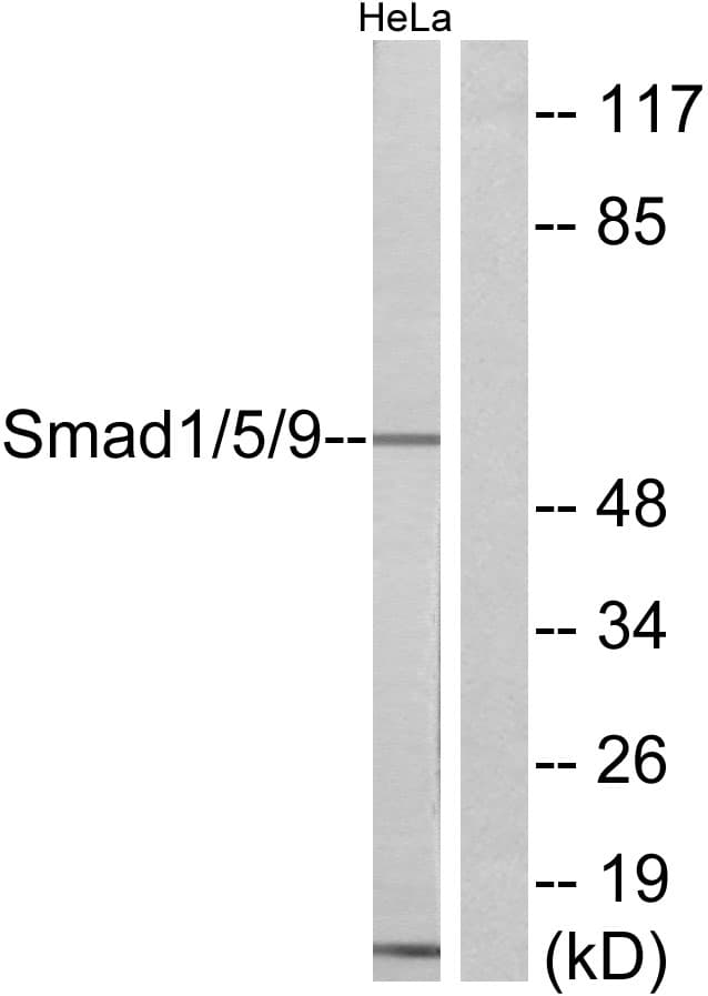 SMAD1+5+9 Antibody (aa10-59)