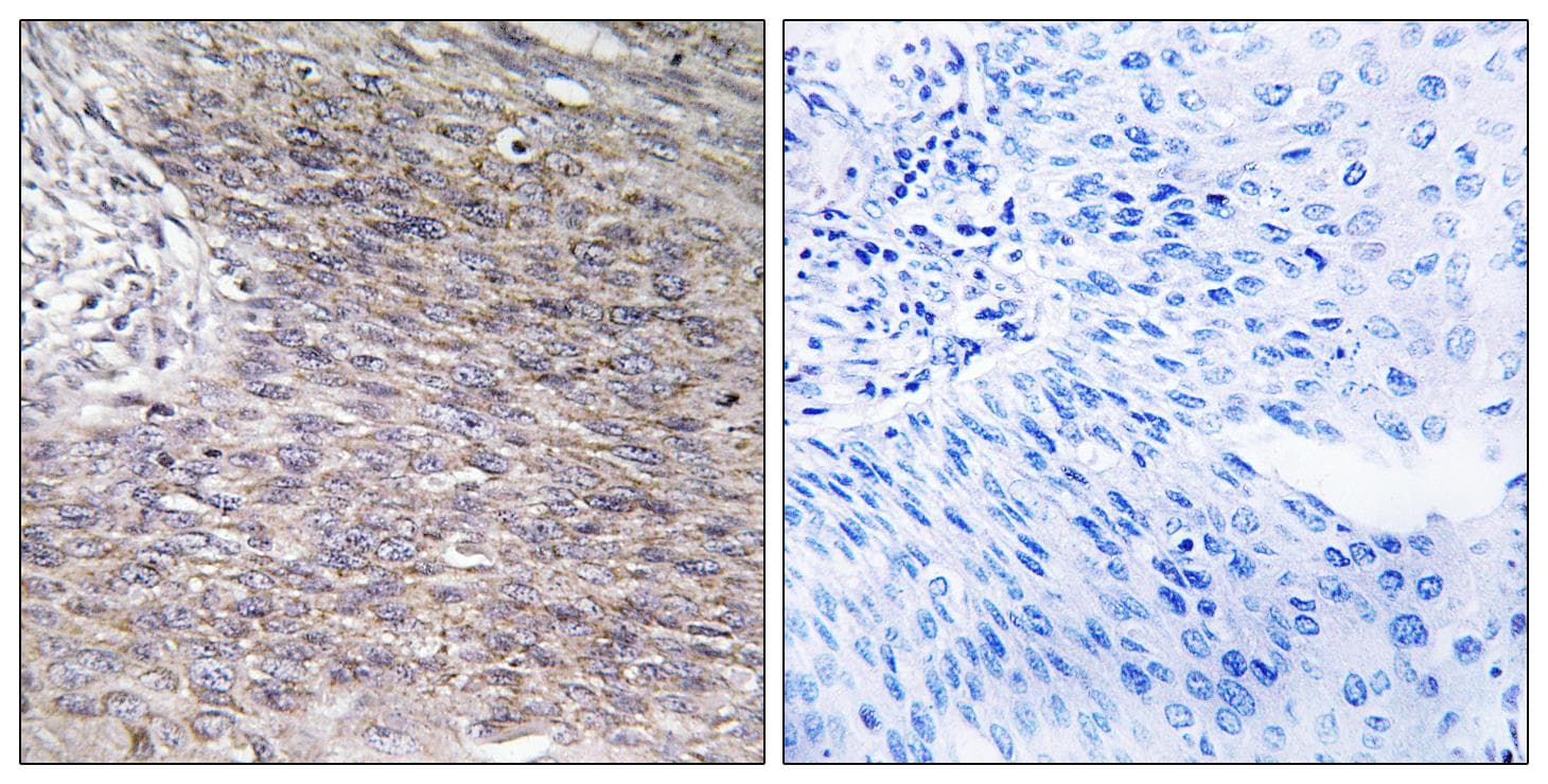CHPF / CHSY2 Antibody