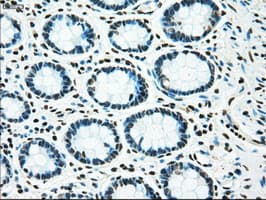Monoclonal Mouse anti-Human TYRO3 Antibody (clone OTI2G2, IHC, WB)