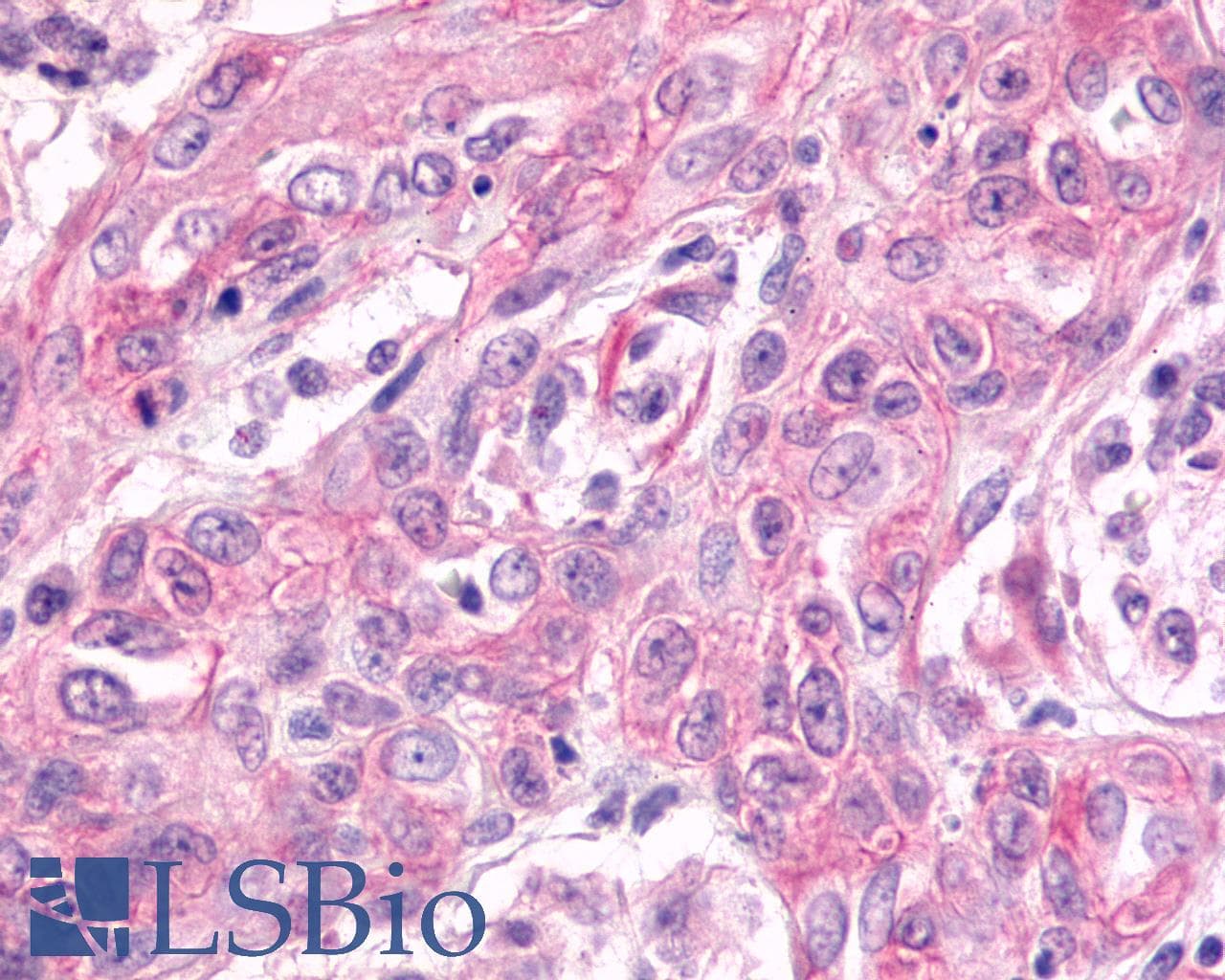 PathPlus™ Polyclonal Rabbit anti-Human GPR17 Antibody (N-Terminus, IHC)