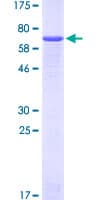 Human DSPG3 / Epiphycan Protein (Recombinant GST)