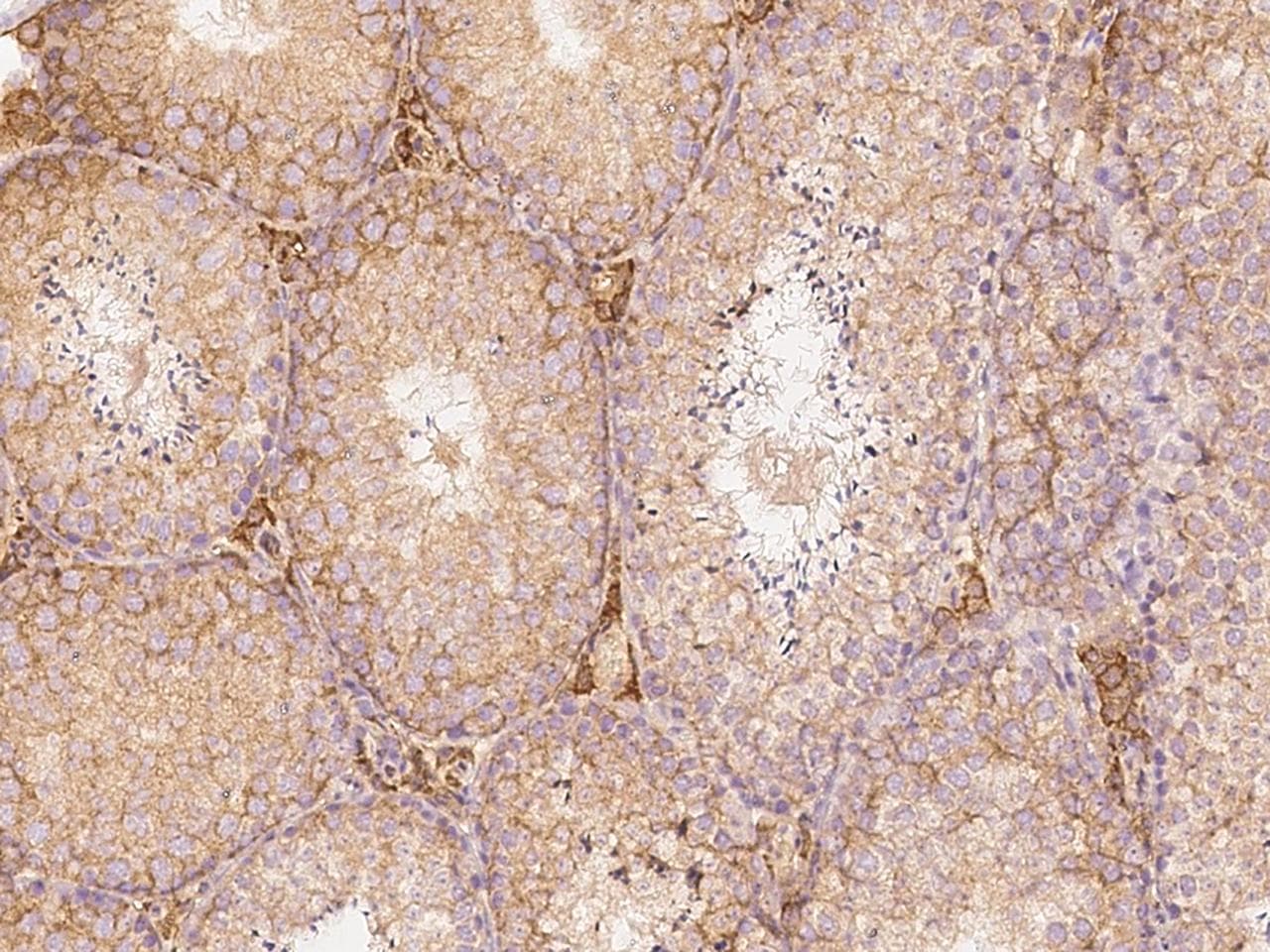 SLC27A3 Antibody (Preservative Free)