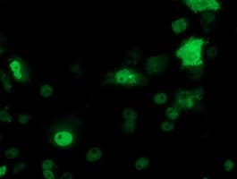 TP53 / p53 Antibody (clone OTI2A4)
