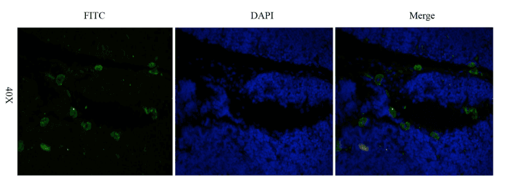 CD52 Antibody (CD52, clone Campath-1H)