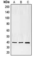 ECI2 / PECI Antibody (Internal)