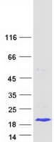Human LGALS7B Protein (Recombinant Myc-DDK (Flag))