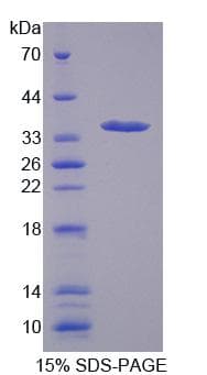 Human SLC25A37 / Mitoferrin Protein (Recombinant His-T7)