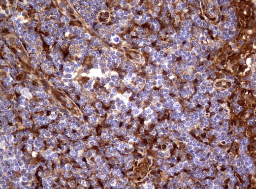 TP / Thymidine Phosphorylase Antibody (aa311-482, clone UMAB97, Carrier-free)