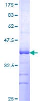 Human GPRC5D Protein (Recombinant GST, N-terminus)