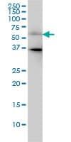 Monoclonal Mouse anti-Human CDC25C Antibody (clone 3B11, IHC, WB)