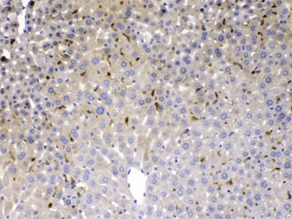 PSAT1 Antibody