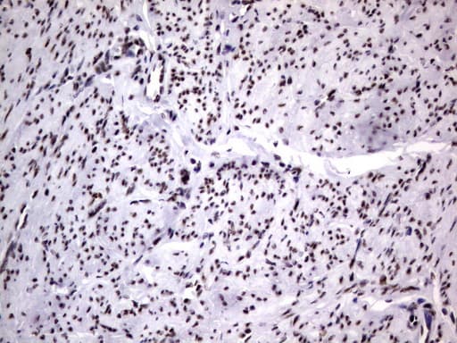 DDX56 Antibody (aa323-547, clone UMAB153)