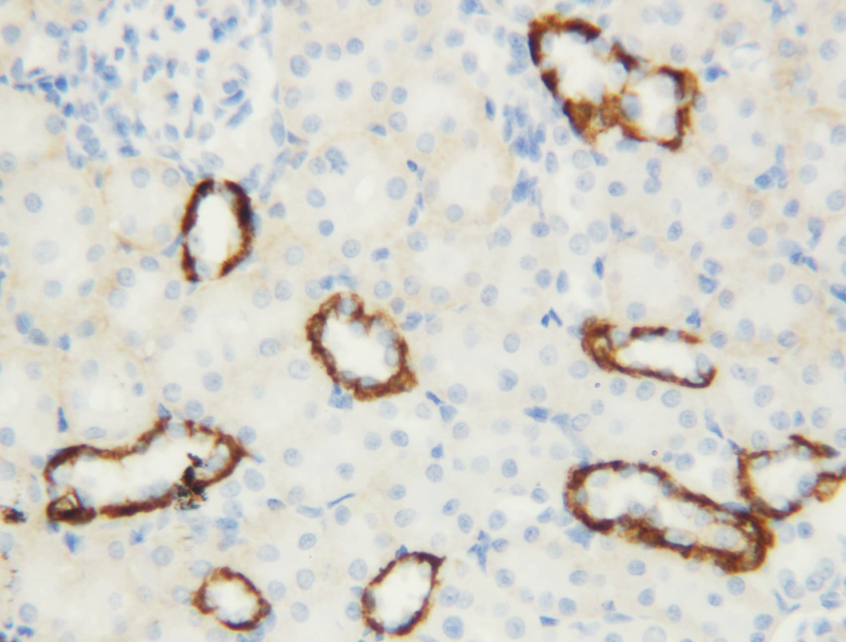 Polyclonal Rabbit anti-Human AQP3 / Aquaporin 3 Antibody (aa278-292, IHC, WB)