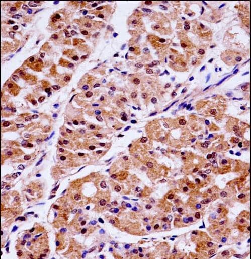 KLK15 / Kallikrein 15 Antibody (aa78-106)