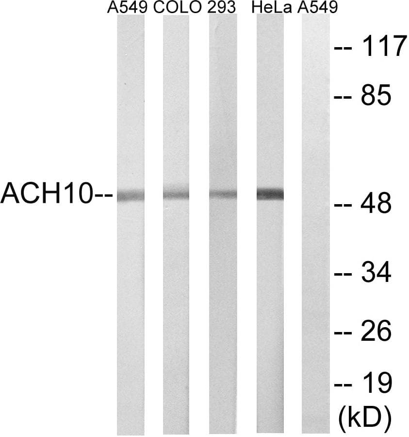 Polyclonal Rabbit anti-Human CHRNA10 Antibody (WB)