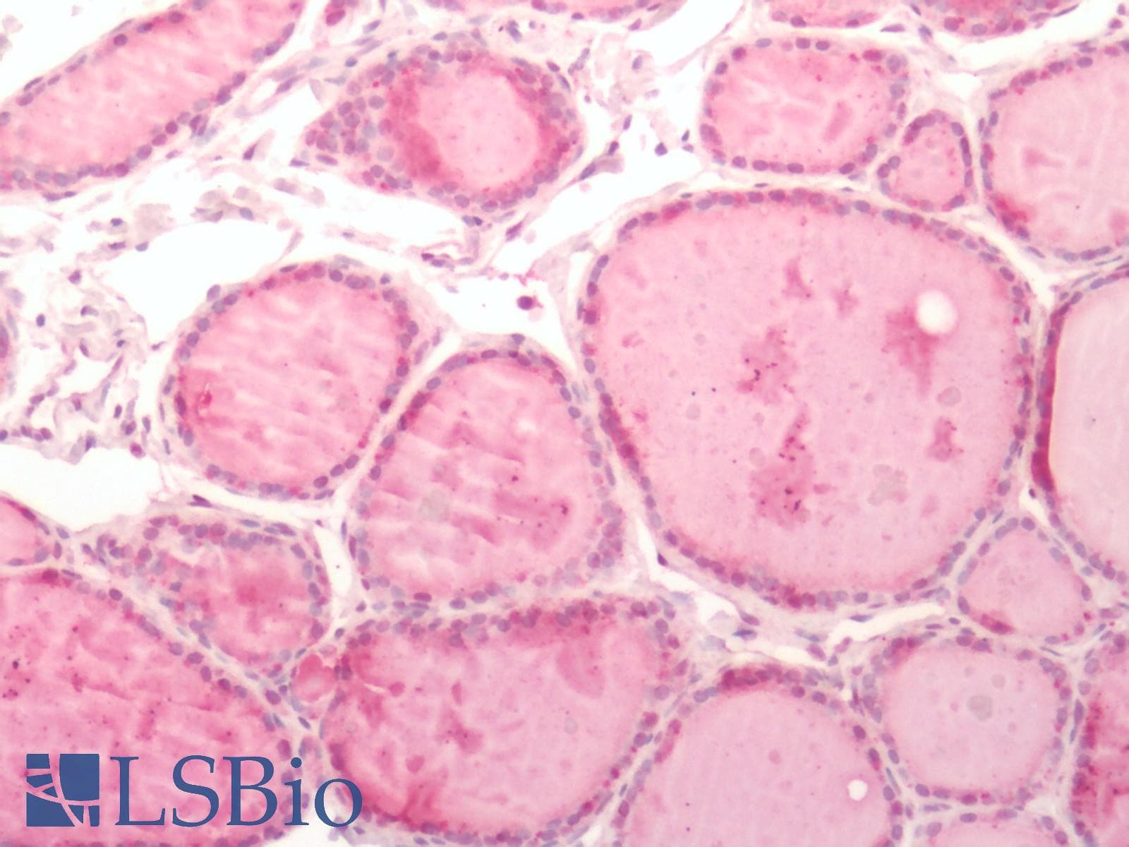 IHC-plus™ ITGB3 / Integrin Beta 3 / CD61 Antibody (N-Terminus)