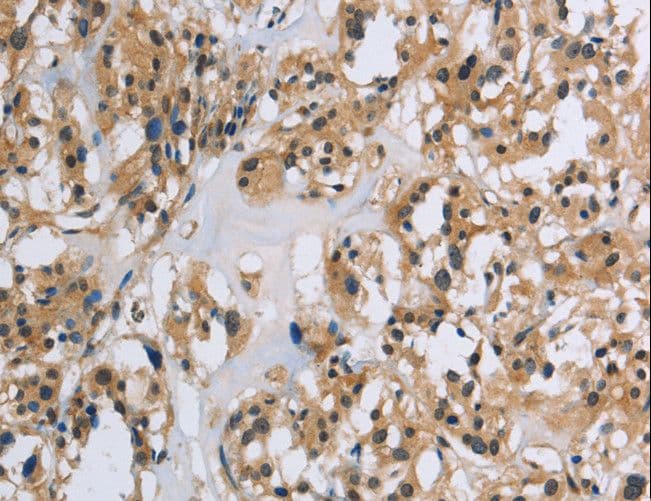 IL5RA / CD125 Antibody