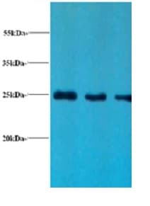 LCN2 / Lipocalin 2 / NGAL Antibody (HRP)
