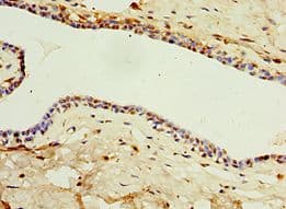 IL22RA1 / IL22R Antibody (aa16-230)