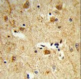 DOLK Antibody (aa312-339)