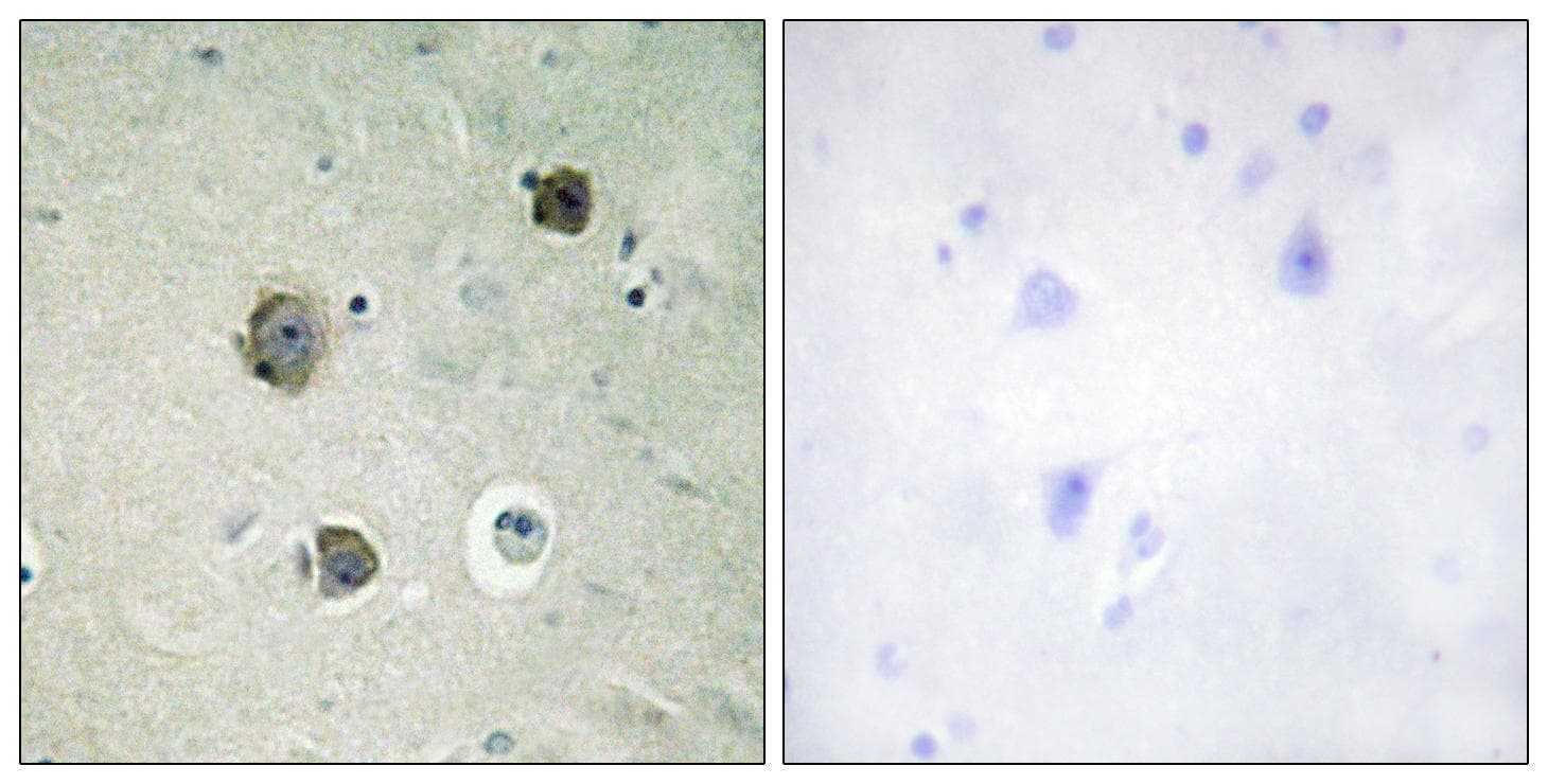 CDK5 Antibody (p15)