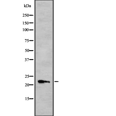 IFNA10 / Interferon Alpha 10 Antibody