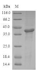 Human ATF7 Protein (Recombinant GST, N-terminus)