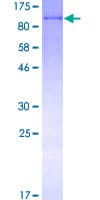 Human SELP / P-Selectin / CD62P Protein (Recombinant GST)