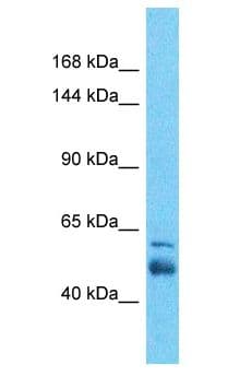 Polyclonal Rabbit anti-Human SLC4A3 / AE3 Antibody (aa36-85, IHC, WB)