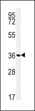 Polyclonal Rabbit anti-Human ATP1B1 Antibody (aa112-138, IHC, WB)