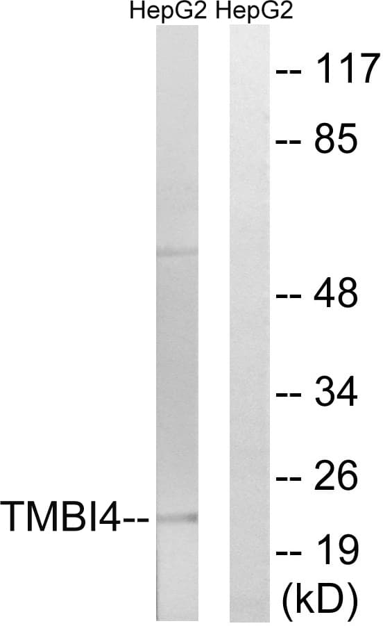 TMBIM4 / GAAP Antibody (aa121-170)
