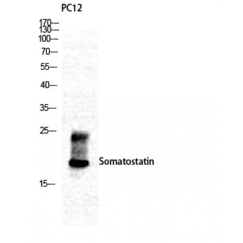 Polyclonal Rabbit anti-Human SST / Somatostatin Antibody (10-90 aa, N-terminal, IHC, WB)