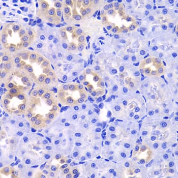 TRP32 / TXNL1 Antibody