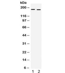 Polyclonal Rabbit anti-Mouse COL1A1 / Collagen I Alpha 1 Antibody (IHC, WB)
