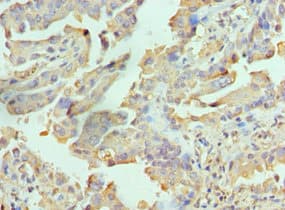 Polyclonal Rabbit anti-Human RICTOR Antibody (aa1-245, IHC)