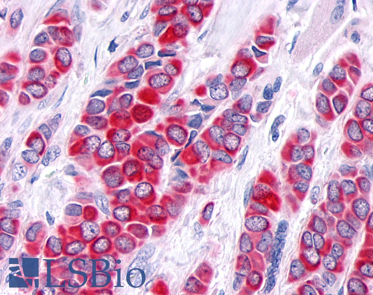 PathPlus™ TNIK Antibody (Internal)