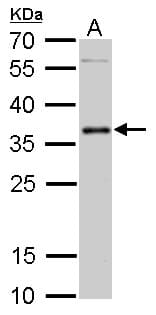PIM2 / Pim-2 Antibody (aa53-278)