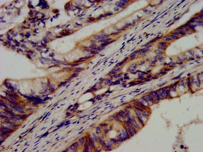 Polyclonal Rabbit anti-Human CDH9 / Cadherin 9 Antibody (IHC, IF, WB)