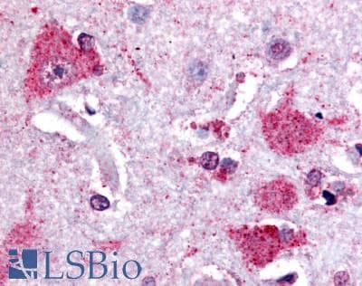 PathPlus™ Polyclonal Rabbit anti-Human PGES / PTGES Antibody (Cytoplasmic Domain, IHC)