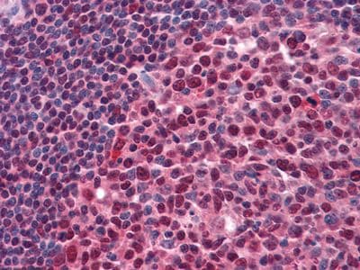 Monoclonal Mouse anti-Human RCHY1 / PIRH2 Antibody (clone 1H10, IHC, IF, WB)