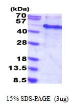 Human RBM13 / MAK16 Protein (Recombinant His)
